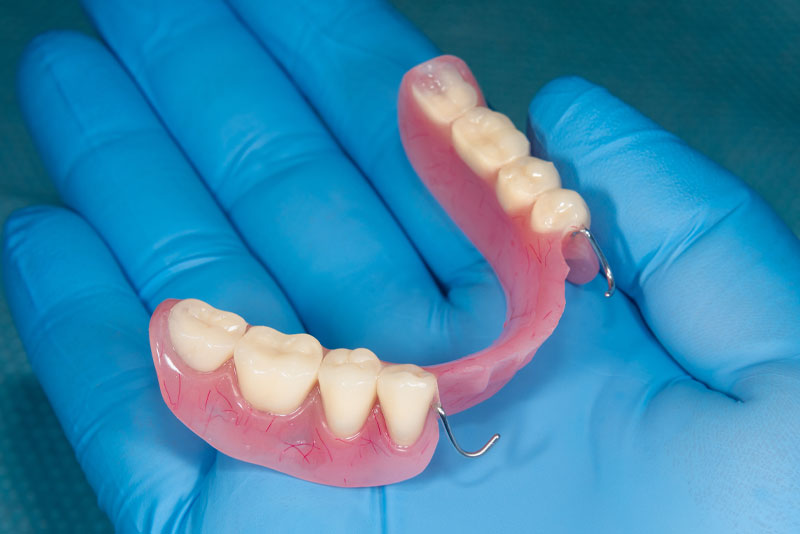 partial denture